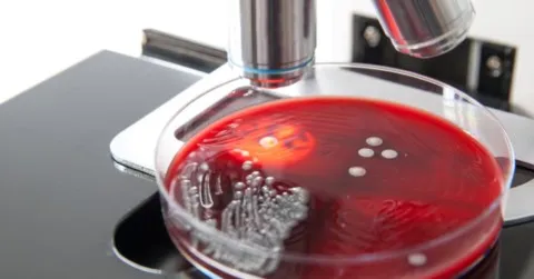 agarplatta med bakterier